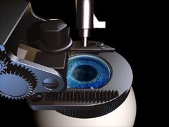 Attachment of the microkeratome.